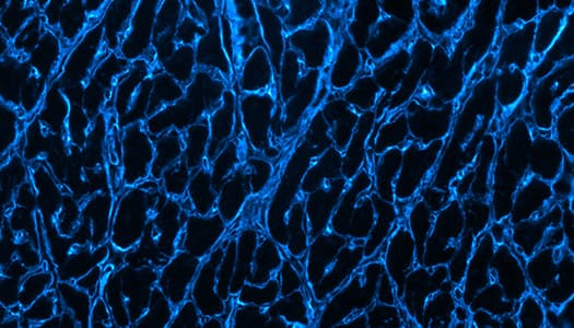 Brilliant blue pig cardiomyocytes collagen lit up with Janelia Fluor Dye 549