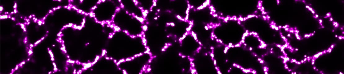Bright pink pig cardiomyocytes in super resolution utilizing Janelia Fluor 549 fluorescent dye