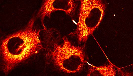 COS7 cells showing up in vibrant red and orange colors from Bio-Techne’s Taxol Janelia Fluor 646 fluorescent dye