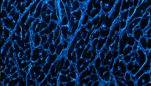 Brilliant blue pig cardiomyocytes collagen lit up with Janelia Fluor Dye 549