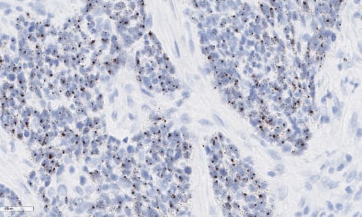 RNAscope High Risk HPV Data Image