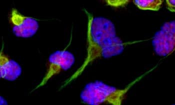 neural stem cells (NSC) in culture at Bio-Techne