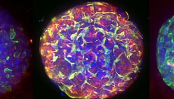 Vibrant, fluorescent organoid utilizing tissue clearing to render the organoid transparent