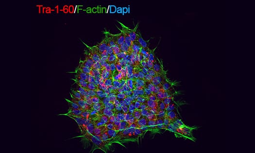 Fluorescence image of a human induced human induced pluripotent stem cell in ExCellerate iPSC Expansion Medium.